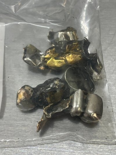 歯科金属　金歯　銀歯　など　17ｇ　歯科材