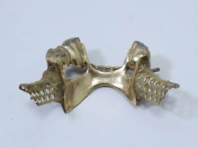 【1円スタート】金歯 金床 金パラ 総重量約20.39g 1-A006/1/60P